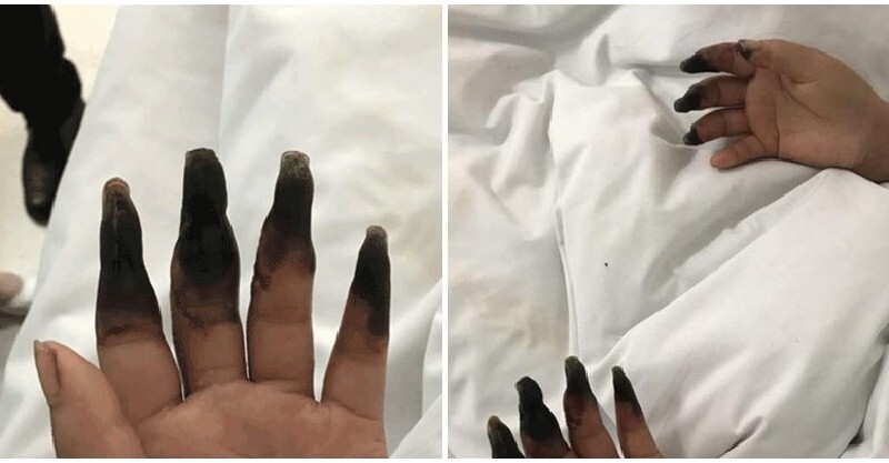 post-thumb