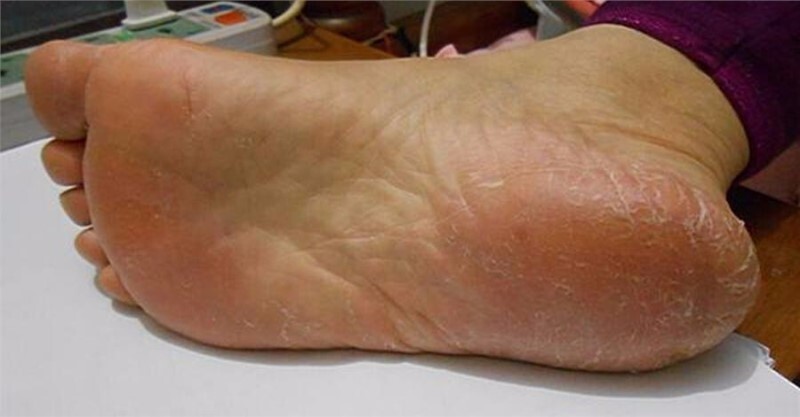 post-thumb
