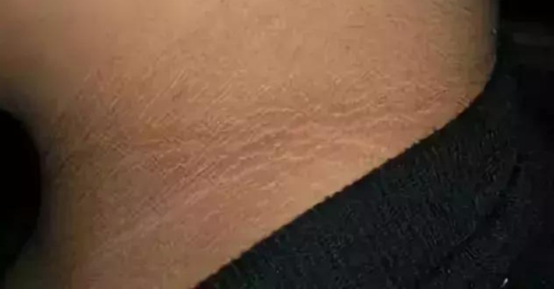 post-thumb