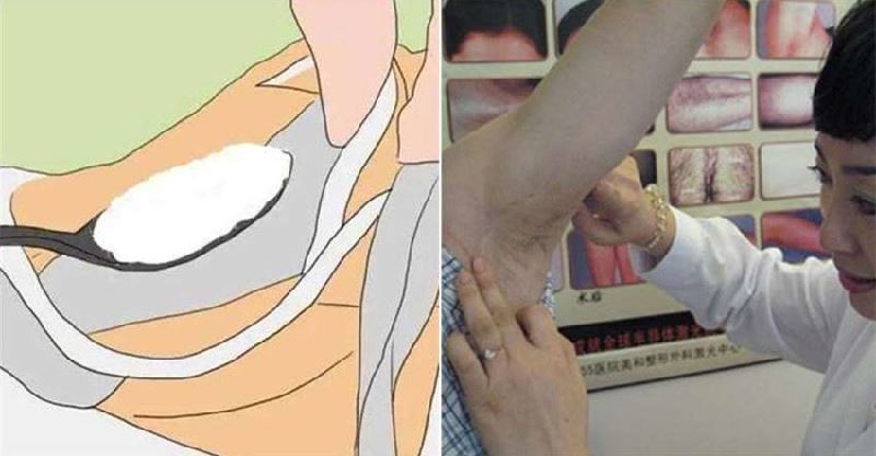 post-thumb
