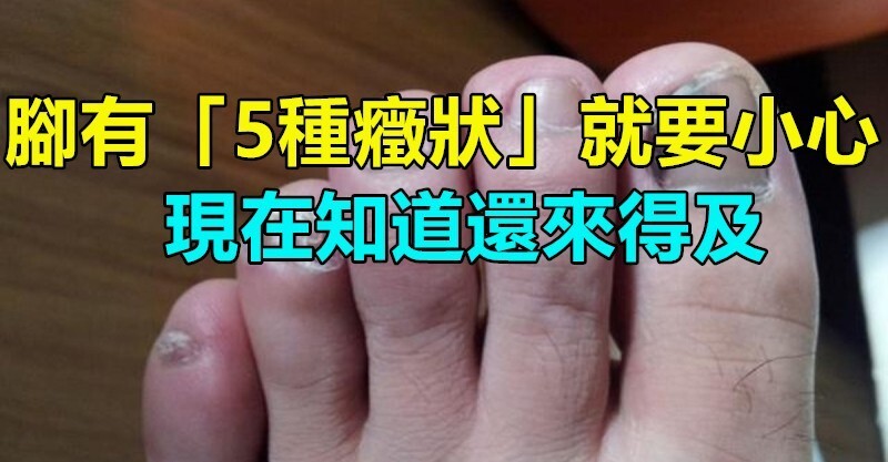 post-thumb