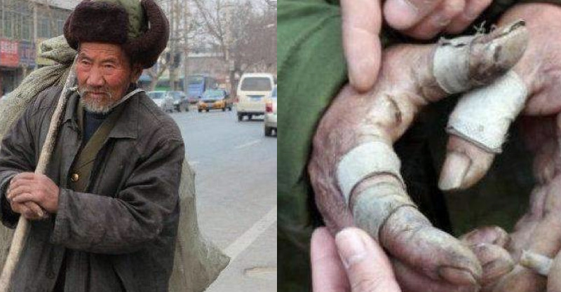post-thumb