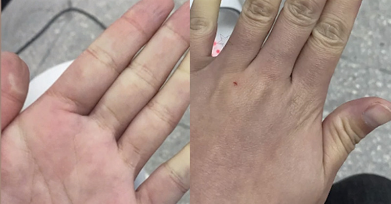 post-thumb
