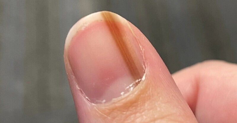 post-thumb