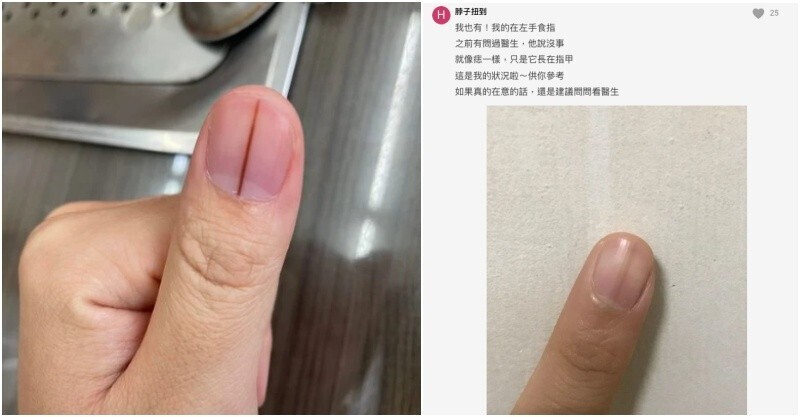 post-thumb