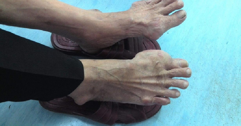 post-thumb