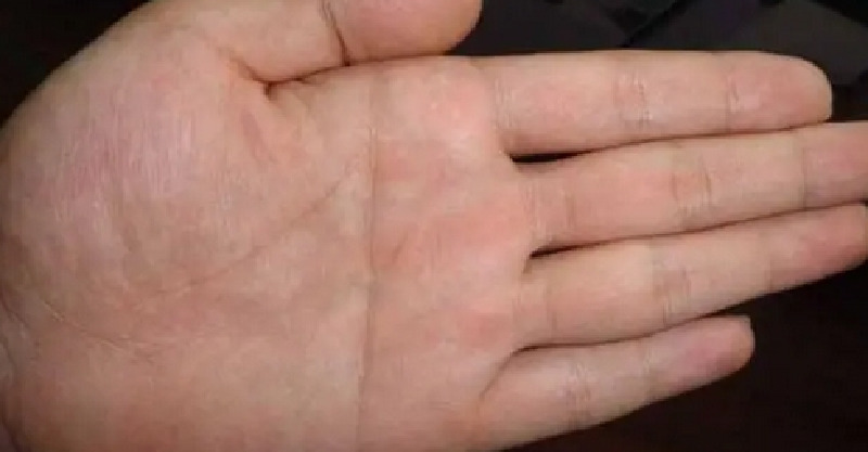 post-thumb