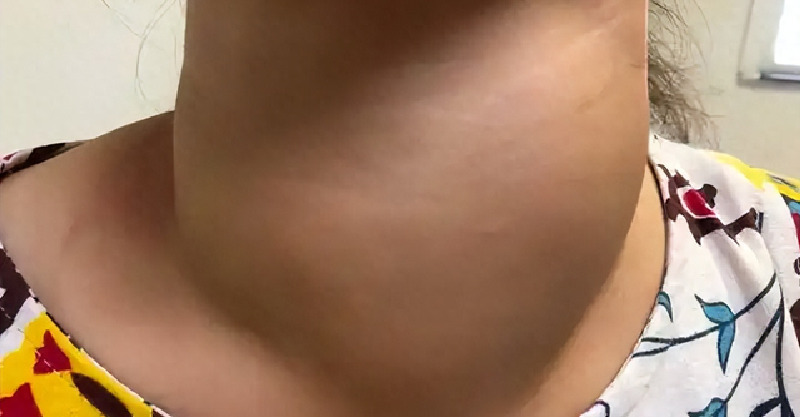 post-thumb
