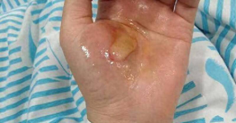 post-thumb
