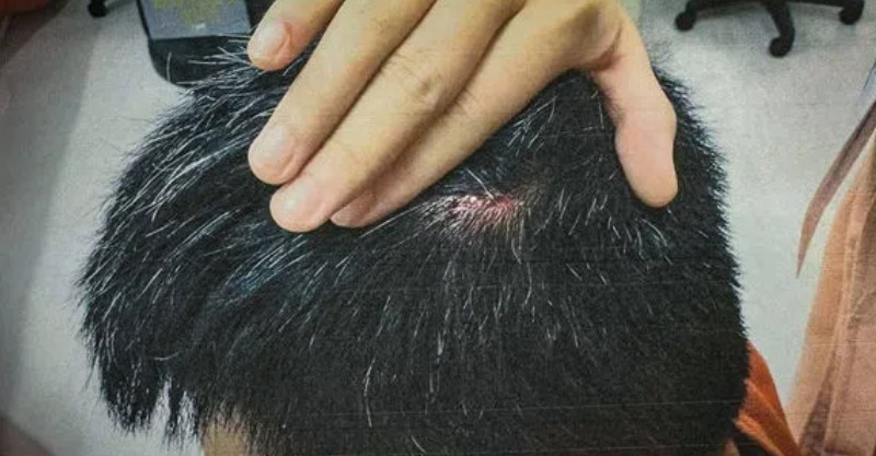 post-thumb