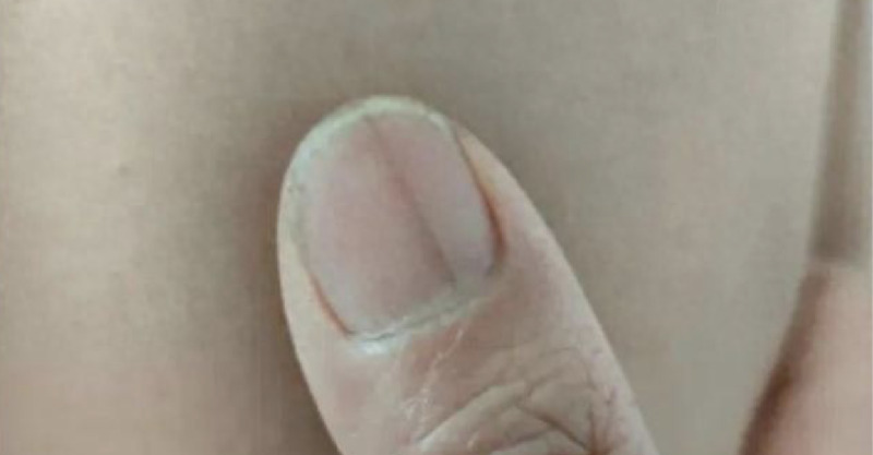 post-thumb